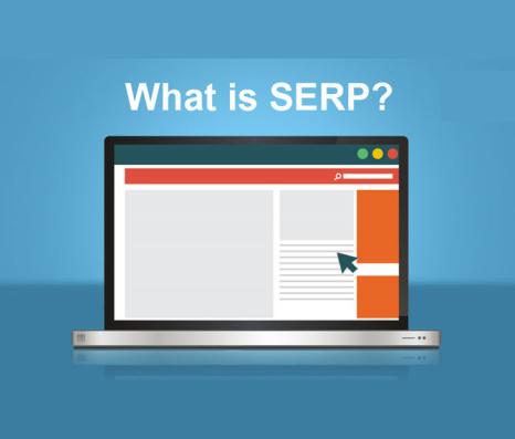 SERP چیست ؟